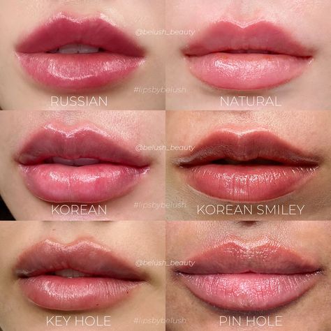 Different Lip Filler Shapes, Lip Surgery, Lips Inspiration, Korean Lips, Lip Augmentation, Numbing Cream, Lip Filler, Full Lips, Lip Shapes