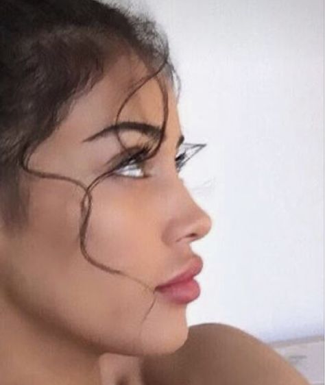 Perfect Jawline, Job Inspiration, Nose Surgery, Funny Memes Images, Button Nose, Cindy Kimberly, Nose Job, Cosmetic Procedures, Side Profile