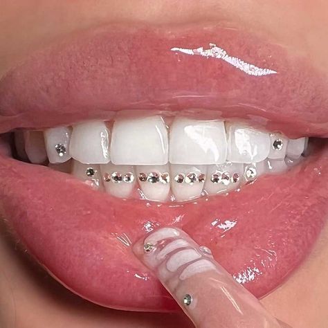 Tooth Gems That Look Like Braces, Gems On Teeth Ideas, Tooth Gems Braces, Tooth Gems Idea, Bottom Row Tooth Gem, Tooth Gems Grill, Easy Tooth Gem Designs, Bottom Tooth Gems Ideas, Cute Tooth Gems Ideas