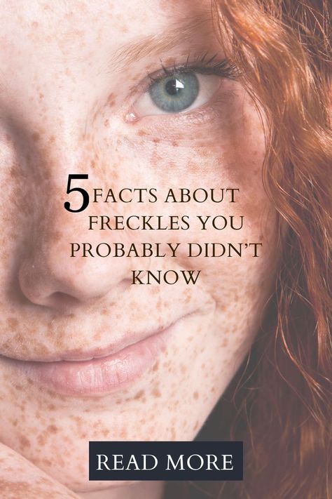 5 Facts About Freckles You Probably Didn’t Know Makeup Ideas Freckles, Freckled Skin Makeup, How To Enhance Freckles Naturally, Makeup For Girls With Freckles, How To Make Your Freckles Pop, Freckles On Tan Skin, Freckles Skin Care, Tattoos Over Freckles, Hair For Freckled Skin