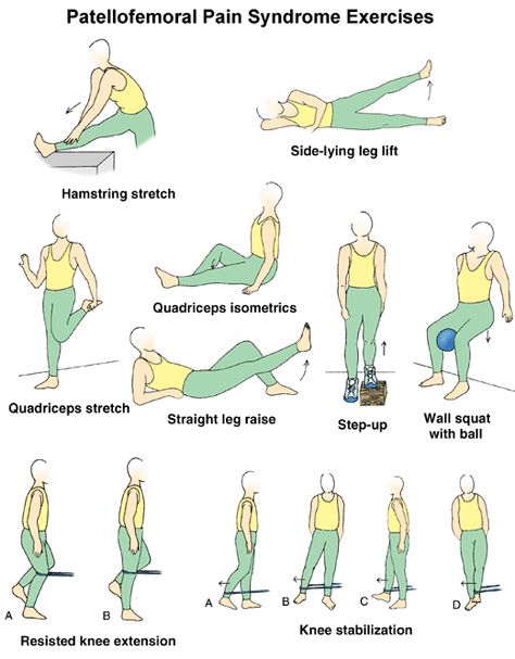 Patella-Femoral-Syndrome Exercises. Patellofemoral Pain Syndrome Exercises, Patella Femoral Syndrome, Jumpers Knee, Patellofemoral Pain Syndrome, Knee Strengthening Exercises, Runners Knee, How To Strengthen Knees, Rehabilitation Exercises, Knee Pain Exercises