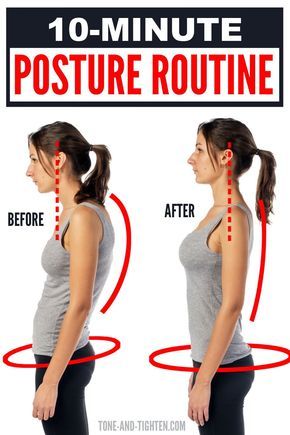 Exercise For Back Straight, Best Excersize For Back, Back Exercises Women Posture, How To Fix Lower Back Posture, How To Fix Upper Back Posture, Flat Back Exercise, Exercises To Strengthen Upper Back, Back Straight Exercise, Fix Your Posture Exercise