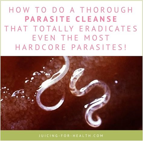 Parasite Cleanse - How To Completely Kill 100+ Types of Parasite Parasite Cleanse Diet, Body Detox Cleanse, Parasite Cleanse, Health Cleanse, Full Body Detox, Cleanse Diet, Natural Detox Drinks, Be The Reason, Healthy Detox