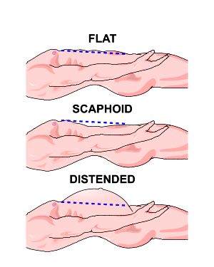 Abdominal Assessment Nursing, Abdominal Regions Anatomy, Abdominal Regions And Organs, Peritonitis Nursing, Tetralogy Of Fallot Nursing, Nursing Skills, Health Assessment, Nurse Study, Nurse Study Notes