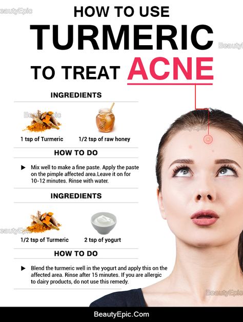 Turmeric for Acne Turmeric For Acne, Skin Care Routine For 20s, Natural Acne Remedies, Natural Acne, Treat Acne, Acne Breakout, Acne Remedies, Looks Black, Acne Skin