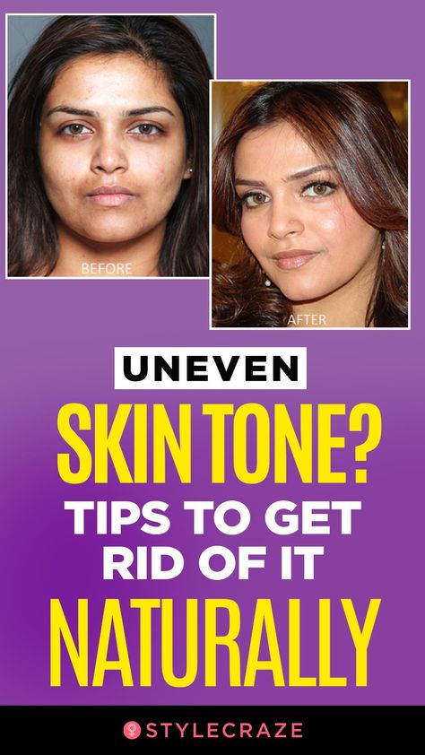 Even Tone Skin Diy, How To Get Even Skin Tone On Face Naturally, Tips For Even Skin Tone, Best Skin Care Products For Uneven Skin Tone, Skincare Routine For Uneven Skin Tone, Skin Care For Even Skin Tone, Diy Face Mask For Even Skin Tone, How To Even Your Skin Tone, Face Mask For Even Skin Tone