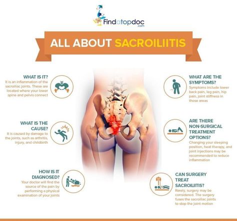 What Is Sacroiliitis: Causes, Symptoms, and Home Remedies Joints In The Body, Nerve Pain Remedies, Lower Back Pain Exercises, Nerve Pain Relief, Lower Back Pain Relief, Sciatic Nerve Pain, Sciatic Nerve, Joints Pain Relief, Back Pain Exercises