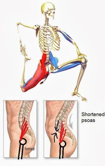 Bolesti Chrbta, Yoga Anatomy, Tight Hip Flexors, Psoas Muscle, Trening Fitness, Lower Back Pain, Hip Pain, Hip Flexor, Yoga Stretches