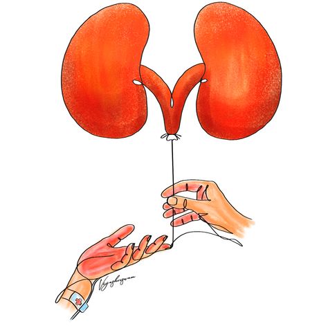 #organ_donation #mathrubhumi #vijeshviswam Kidney Donation Poster, Transplant Party, Organ Donation Poster, Kidney Donation, Kidney Stone, Organ Transplant, Organ Donation, Deep Meaning, Learn Art