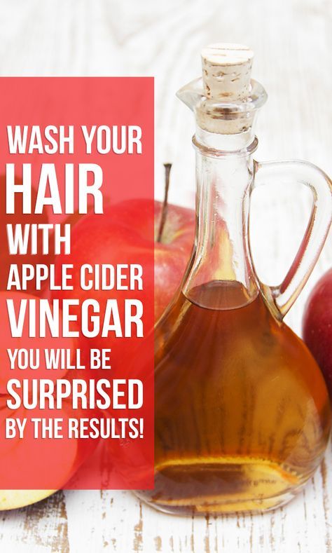 Apple Cider Vinegar Hair Rinse, Vinegar For Hair, Vinegar Hair Rinse, Apple Cider Vinegar Rinse, Apple Cider Vinegar For Hair, Vinegar Rinse, Washing Your Hair, Cold Sores Remedies, Costume Noir