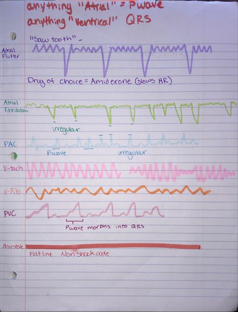 Med Surg Nursing Cardiovascular, Cardiac Arrhythmias Nursing, Med Surg Cardiovascular, Nursing School Med Surg, Med Surg 2 Nursing, Med Surg Cardiac, Cardiac Assessment Nursing, Cardiac Rhythms Cheat Sheets, Peds Cardiac Nursing