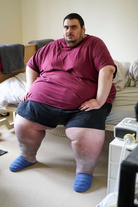 BRITAIN’S fattest man wants a gastric bypass for Christmas – after piling on most of the weight he lost over the past year. Super-morbidly obese Jason Holton was last seen being winched from his old, third-floor flat by crane in 2020 after he ballooned to a terrifying 50st. Jason, 31, managed to lose 10st in […] Whale Costume, Messi Pictures, Chubby Men, Shock And Awe, Disney Princess Movies, Gastric Bypass, Fat Man, Disney Princess Art, The Past