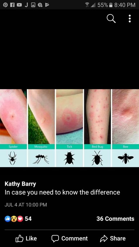 How each insect bite looks. Insect Bite Identification Chart, Types Of Bug Bites, Snake Repellant Plants, Snake Repellant, Different Spiders, Remedies For Mosquito Bites, Insect Bite, Frosty Recipe, Types Of Spiders