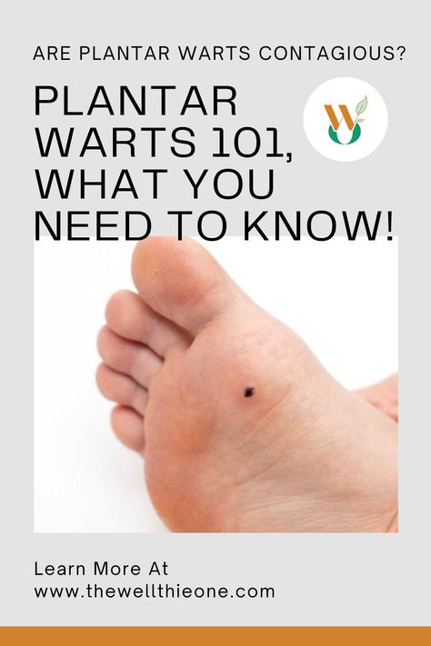 Are Plantar Warts Contagious? Plantar Warts 101, What You Need To Know! Planters Wart, Plantar Warts, Home Remedies For Warts, Warts Remedy, Wart Remover, Skin Growths, Skin Natural Remedies, Cold Sores Remedies, Natural Sleep Remedies