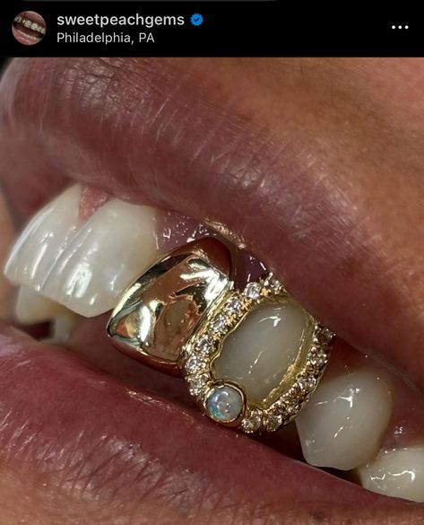 Front Tooth Grill, Colorful Grillz, Grills For Gap Teeth, Two Tooth Grillz, Grill Design Teeth, Bottom Grillz For Women, Women’s Grills, Grillz For Females Aesthetic, Gold Grill Women