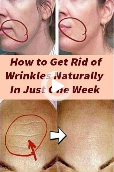 >>CHECK THIS OUT<< How to Prevent Wrinkles: Natural Anti-Aging Wrinkle Remedies Regular Skin Care Routine, Get Rid Of Wrinkles, Wrinkle Remedies, Wrinkle Free Skin, Skin Lightener, Forehead Wrinkles, Best Skin Care Routine, Anti Aging Wrinkles, Natural Anti Aging