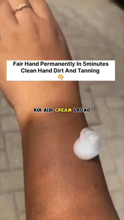 home remedies for removing tanning Pigmentation Remedy, Closed Comedones, Face Mask For Pimples, Skin Tan Removal, Skin Blackheads, Beginner Skin Care Routine, Pimples Remedies, Face Skin Care Routine, Tan Removal