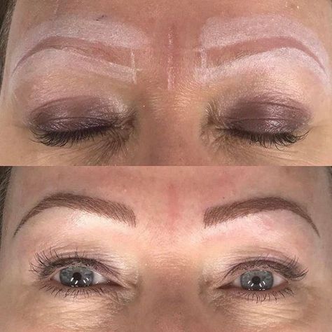 Microblading eyebrows for thyroid patients Thyroid Hair, Microblading Aftercare, Eyebrow Before And After, Thick Hair Remedies, Thick Hair Growth, Eyebrow Growth, Hair Remedies For Growth, Grow Hair Faster, Microblading Eyebrows