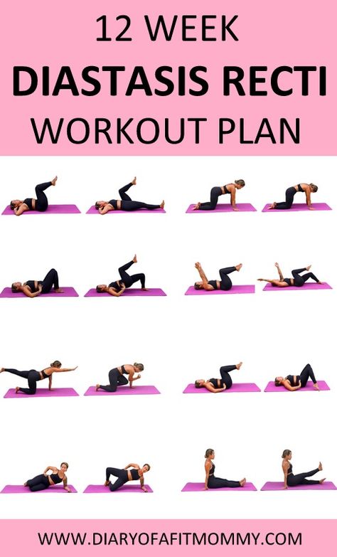 Diastasis Recti Healing, Yoga Diastasis Recti, Exercises For Post Partum Belly, Diastasis Recti Core Exercises, Post Partum Core Workout At Home, Core Workouts For Diastis Recti, Ab Workouts Diastasis Recti, Diastis Recti Exercises Workout Plan, Diary Of A Fit Mommy Diastasis Recti