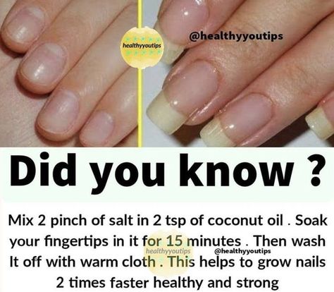 Pin by Nakami Rukayyah on Nailed it! | Natural skin care diy, Natural skin care r… | Natural skin care diy, Natural skin care remedies, Beauty tips for glowing skin How To Keep Natural Nails Healthy, Gel Mani On Natural Nails, Best Nail Growth Products, Growing Nails Tips, Strong Nails How To Get, Natural Nail Growth, Grow Long Nails, Nail Growth Tips, Natural Skin Care Remedies