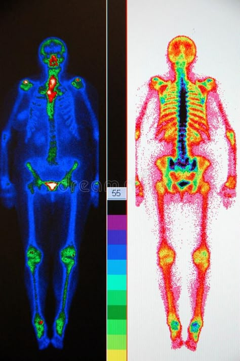 Nuclear Medicine Technologist Aesthetic, Nuclear Medicine Technologist, Gestalt Principles, Nuclear Magnetic Resonance, Nuclear Technology, Body Scan, Medical Student Motivation, Nuclear Medicine, Diagnostic Imaging