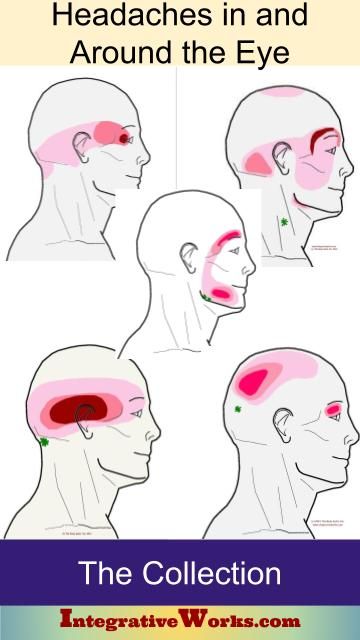 Headache Behind Eyes, Forward Head Posture Exercises, Throbbing Headache, Neck And Shoulder Muscles, Eye Pain, Forward Head Posture, Head Pain, Blood Sugar Diet, Healthy Diet Tips