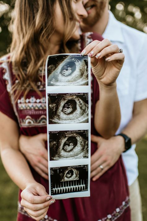 Baby announcement photo with sonogram Sonogram Picture Ideas Couple, Sonogram Photoshoot Ideas, Sonogram Maternity Photos, Sonogram Announcement Ideas, Sonogram Photoshoot, Baby Sonogram Pictures, Ultrasound Announcement Ideas, Sonogram Picture Ideas, Sonogram Announcement