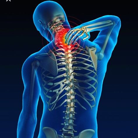 The vertebrae of the week is T3! This thoracic vertebrae affects the lungs bronchial tubes and chest. Symptoms could include congestion get T3 checked today! #hschan #highlightinghealth Stiff Neck Remedies, Cervical Spondylosis, Stiff Neck, Spine Surgery, Power Trip, Sciatic Nerve Pain, Neck Pain Relief, Sciatic Nerve, Strengthening Exercises