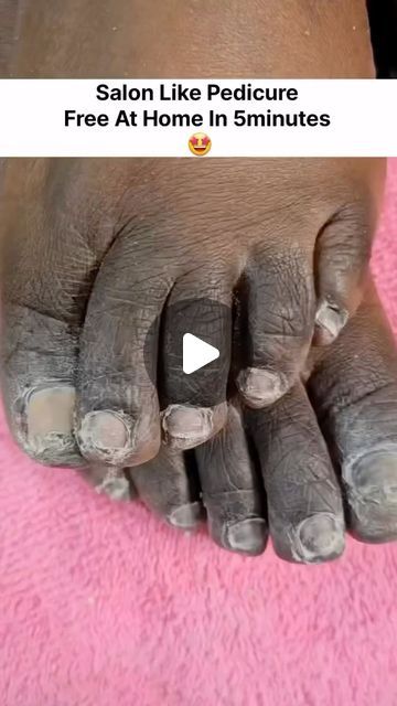 Bridal Pedicure, Acrylic Nail Designs Classy, Pedicure Tips, Feet Nail Design, Diy Pedicure, Homemade Facial Mask, Face Skin Care Routine, Foot Pedicure, Diy Skin Care Routine