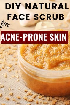 Diy Face Scrubs For Acne, All Natural Face Scrub, Diy Body Scrub For Acne, Homemade Acne Scrub, Natural Face Scrub For Acne, Acne Soap Diy, Best Facial For Acne, Facial Scrubs Diy Exfoliating For Acne, Face Scrubs For Acne