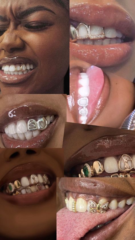 Grills For Women, Gold Teeth Grills, Gold Teeth Grillz, Girl Grillz, Teeth Aesthetic, Pretty Teeth, Dental Jewelry, Grillz Teeth, Xoxo Jewelry