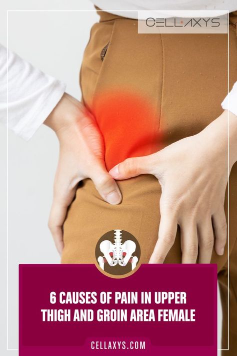 6 Causes of Pain in Upper Thigh and Groin Area Female Thigh Muscle Pain, Leg Muscle Pain, Nerve Pain Remedies, Core Exercises For Women, Hip Pain Relief, Pain Relief Remedies, Upper Back Pain, Nerve Pain Relief, Thigh Muscles