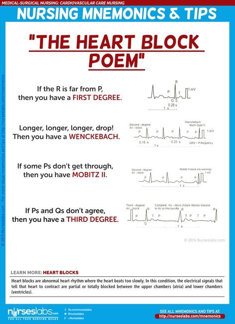 Ekg Mnemonics, Cardiovascular Disease Nursing, Heart Valves Mnemonics, Siadh Nursing Mnemonic, Heart Blocks Nursing, Blood Flow Through The Heart Mnemonic, Pcu Nurse Tips, Perfusion Nursing, Ekg Interpretation Made Easy