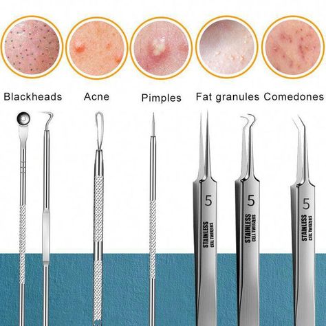 Best Blackhead Remover, Clean Skin Face, Pimple Extractor, Sebaceous Filaments, Blackhead Extraction, Big Pores, Blackhead Remover Tool, How To Remove Pimples, Blemish Remover