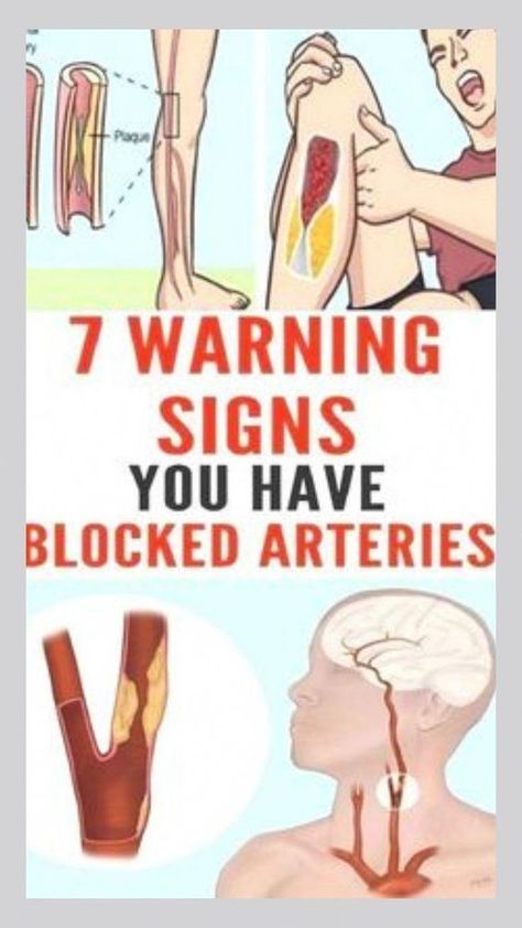 Here are 7 warning signs that indicate clogged arteries Healthy Habits Challenge, What Is Health, Healthy Living Motivation, Clogged Arteries, Health Signs, Wellness Inspiration, Healthy Mindset, Body Confidence, Good Health Tips