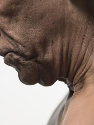 Who else wants a beautiful neck?  When you check this out you will be on your way to one.  Guaranteed.  http://lawebmarketers.net/wrinklefree http://lawebmarketers.net/wrinklefree Sagging Neck Skin, Neck Tightening, Sagging Neck, Turkey Neck, Neck Exercises, Neck Wrinkles, Muscles In Your Body, Saggy Skin, Face Wrinkles