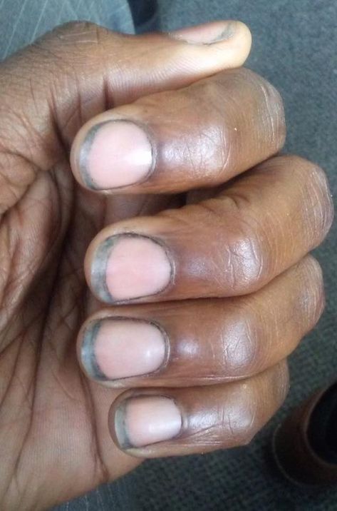 Dirty Nails, Remove Acrylics, Remove Acrylic Nails, Acrylic Nails At Home, Nails At Home, Island Girl, Fashion Hacks Clothes, Cute Nail Designs, Funky Nails