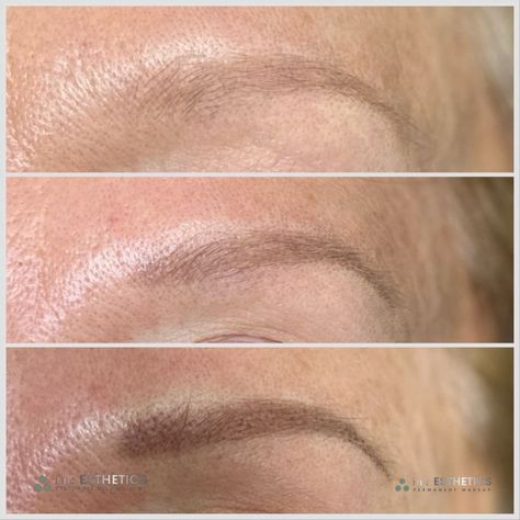 Picture shows the progression of Powder Brows over the 2 sessions required for optimal results. 
1️⃣ Top - Before
2️⃣ Middle - 6 weeks healed
3️⃣ Bottom - Post 2nd session
------
PRODUCTS: 
#1003RL with Micropigmentation Signature Collection #Taupe & a smidge of Dark Walnut Powder Brows Healing Stages, Ombre Powder Brows Healing Process, Tattooing Machine, Microblading Eyebrows Hair Strokes, Types Of Eyebrows, Microblading Healing Process, Stages Of Microblading Healing, Permanent Eyebrows, Permanent Makeup Eyebrows