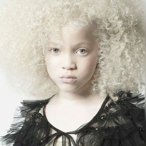 Beautiful!!! Bowie Eyes, Hair Whorl, Albino Girl, Different Colored Eyes, African American, Pretty People, Beautiful People, A Woman, Natural Hair Styles