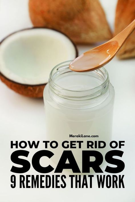 How To Get Rid Of Scars, Get Rid Of Scars, Acne Scar Remedies, Getting Rid Of Scars, Scar Remedies, How To Fade, Lighten Scars, Skin Natural Remedies, Home Remedies For Acne