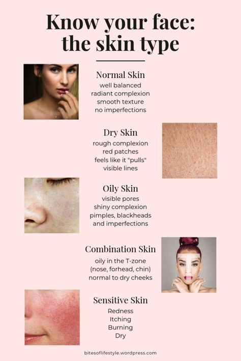 Know your face: a complete guide to skin types and phototypes – Bits of Life Skin Types Chart, Remove Skin Tags Naturally, Skin Facts, Skin Moles, Acne Overnight, Underarm Hair Removal, Natural Acne Remedies, Weight Workout, Skin Redness