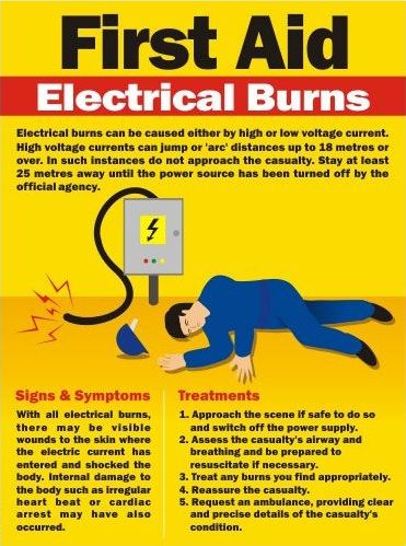 First Aid Poster, First Aid Procedures, First Aid Tips, Basic First Aid, Emergency First Aid, Safety Posters, Workplace Safety, Emergency Prepping, Medical Knowledge