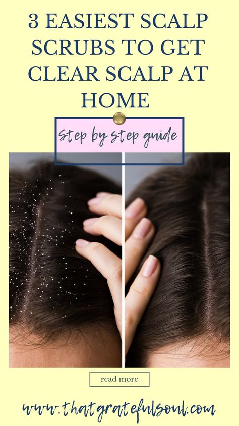 Here are Easy and best diy scalp scrub,diy scalp scrub for buildup,for hair growth, for dandruff hair growth, for itchy scalp,for dry scalp,diy scalp scrub oily hair,diy scalp scrub recipes, for psoriasis. #haircare #diy #homeremedies Clean Scalp Build Up Diy, Homemade Scalp Scrub For Dandruff, Diy Dry Scalp Mask, Clean Scalp Diy, How To Make A Scalp Scrub, Diy Scalp Scrub For Buildup And Dandruff, Diy Scalp Scrub For Itchy Scalp, Natural Remedies For Dry Scalp, Psoriatic Scalp Remedies