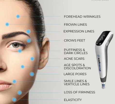 The Dermapen4 combined with PRP Collagen Induction can treat all this and more! It is the most innovative Aesthetics breakthrough in decades! #dermapen4 #wrinkles #antiaging #acnescars #beauty #microneedling #agereversal #skincare #amazing #aestheticspueblo #thebestantiagingskincareproducts Dermapen Microneedling, Vampire Facial, Derma Pen, Platelet Rich Plasma, Forehead Wrinkles, Skin Resurfacing, Skin Clinic, Tattoo Removal, Skin Healing