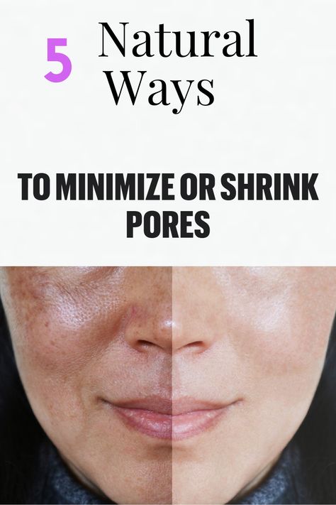 Make Pores Smaller, Big Pores, Nose Pores, Lotion For Oily Skin, Oily Skin Acne, Face Pores, Open Pores, Tips For Oily Skin, Smaller Pores