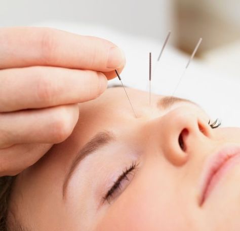 Researchers Find Proof that #Acupuncture Blocks #Stress #mentalhealth Acupuncture Benefits, Brain Chemistry, Shiatsu Massage, Acupuncture Points, Acupressure, Chinese Medicine, Alternative Medicine, Migraine, Acupuncture