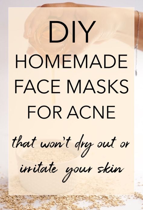 DIY Face Masks For Acne and Oily Skin #homefacemask #diyfacemask #homemadefacemask #acnefacemask #oilyskin #acneprone Homemade Face Masks For Acne, Face Masks For Acne, Masks For Acne, Acne Products, Mask For Oily Skin, Acne Overnight, Acne Mask, Diy Beauty Treatments, Acne Face Mask