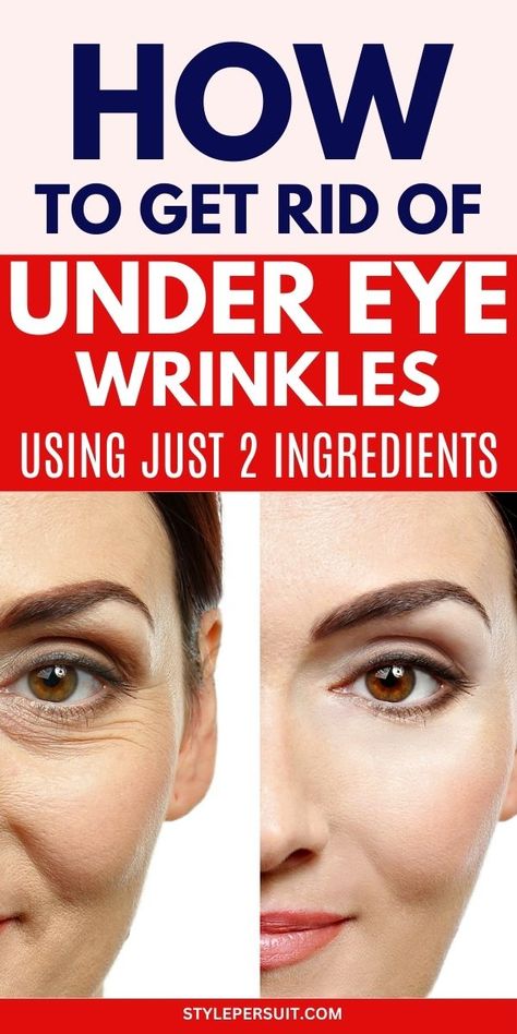 20 Best Under Eye Wrinkles Remedies – StylePersuit Natural Eye Wrinkle Remedies, Wrinkles Under Eyes Remedies, Wrinkle Under Eyes Remedies, Wrinkles Under Eyes Get Rid Of, How To Remove Wrinkles On Face, How To Remove Eye Wrinkles, Under Eye Care Routine, Wrinkles Around The Eyes, How To Remove Under Eye Wrinkles