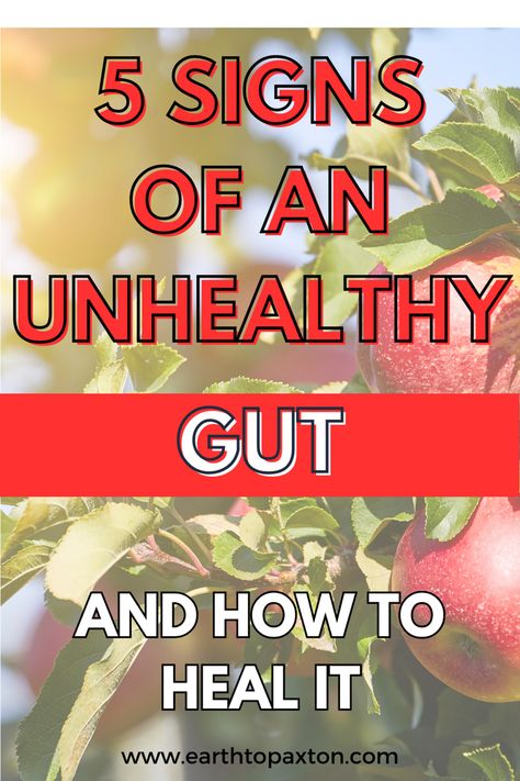 Foods to Heal Leaky Gut | Gut Health Diet | Leaky Gut Symptoms Natural Remedies |   Gut Healing Diet | Leaky Gut Remedies Foods To Help Heal Your Gut, Healing Gut Foods, Best Diet For Gut Health, Gut Health Remedies, Healing Gut Inflammation, How To Heal Your Gut Microbiome, Recipes To Heal Your Gut, How To Naturally Heal Your Gut, What Is A Leaky Gut