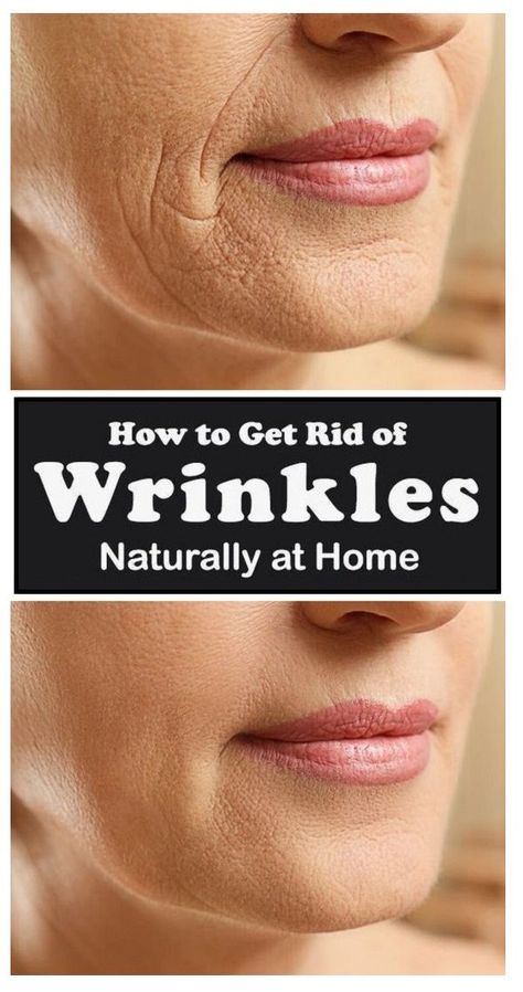 As the age increases with the passage of time, the skin begins losing its spring and wrinkles start appearing on our skin, which is a thing to be concerned about. But calm down! These simple and easy home medications may help one to deal with or at least reduce the wrinkles to some extent Be in […]